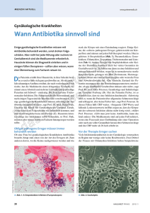 Wann Antibiotika sinnvoll sind