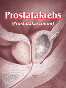 Prostatakarzinom - Pro Patient online