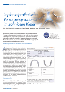 Implantatprothetische Versorgungsvarianten im zahnlosen Kiefer