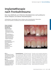 Implantattherapie nach Frontzahntrauma