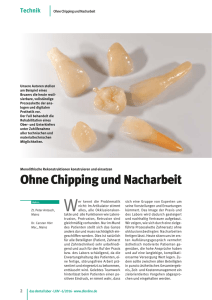 Ohne Chipping und Nacharbeit