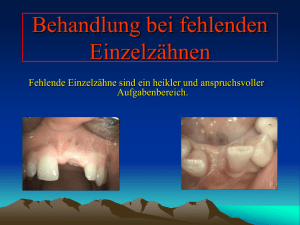 Behandlung bei fehlenden Einzelzähnen