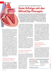 Gute Erfolge mit der MitraClip-Therapie