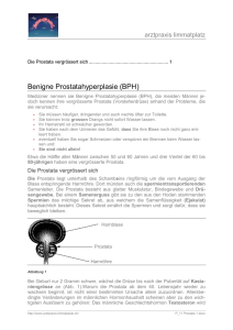 Benigne Prostatahyperplasie (BPH)