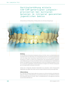 Vertikalerhöhung mittels CAD-CAM