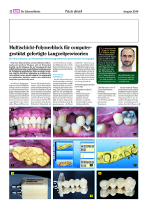 Multischicht-Polymerblock für computer