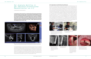 Der digitale Workflow in der Implantat