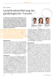 Lymphknotenentfernung bei gynäkologischen Tumoren
