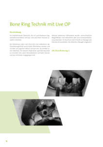 Bone Ring Technik mit Live OP