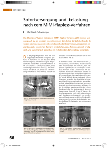 Sofortversorgung und -belastung nach dem MIMI-flapless