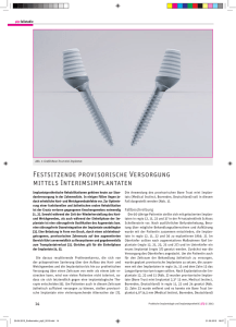 Festsitzende provisorische Versorgung mittels