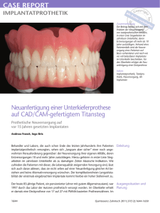 PDF-Datei - Wandtke Dental