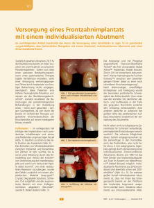 Versorgung eines Frontzahnimplantats mit einem individualisierten