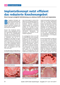 Implantatkonzept nutzt effizient das reduzierte