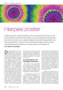 Herpes zoster