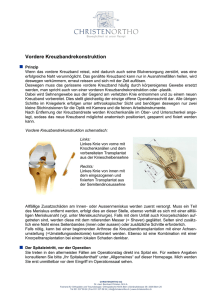 Vordere Kreuzbandrekonstruktion