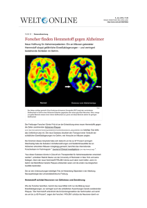 Forscher finden Hemmstoff gegen Alzheimer