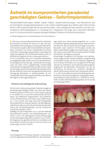 Ästhetik im kompromitierten paradontal geschädigten Gebiss