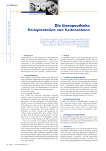 Die therapeutische Reimplantation von Seitenzähnen