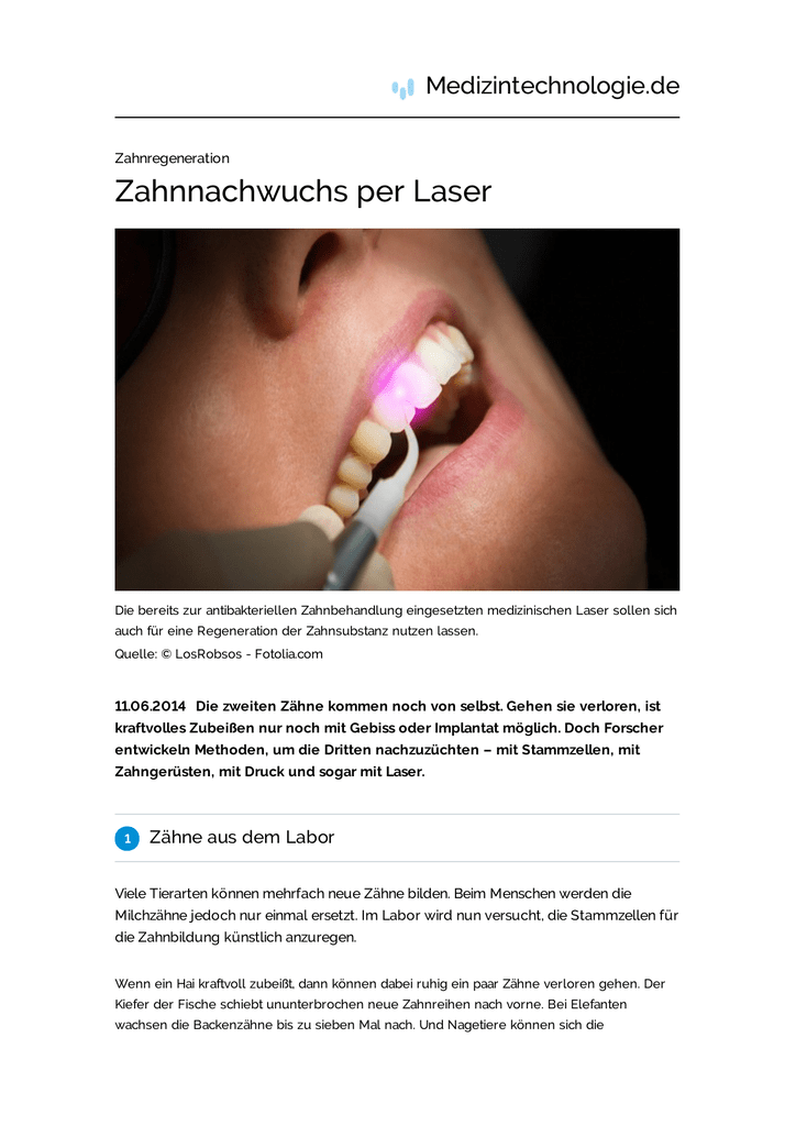 Zahnnachwuchs Per Laser
