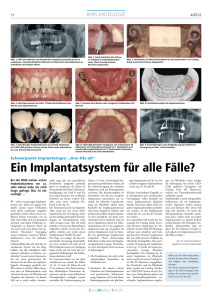 Zahn.Medizin.Technik 04.2012 Ein Implantatsystem