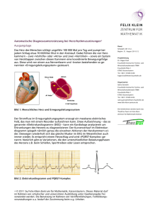 Automatische Diagnoseunterstützung bei Herzrhythmusstörungen
