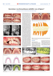 Korrektur von Kreuzbissen mithilfe von eCligner®