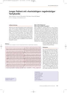 Junger Patient mit «hartnäckiger» regelmässiger Tachykardie