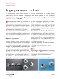 Augenprothesen aus Glas - Kunstaugenpraxis Birke