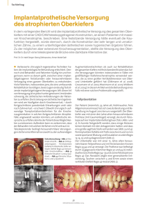 Implantatprothetische Versorgung des atrophierten