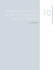 Mythen und Fakten in der Festsitzenden klasse-ii