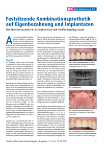 Artikel DZW 1/12: Festsitzende Kombinationsprothetik auf