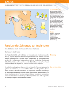 Festsitzender Zahnersatz auf Implantaten