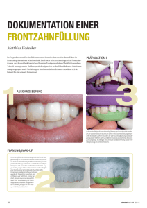 Dokumentation einer Frontzahnfüllung