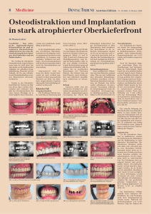 Osteodistraktion Dental Tribune