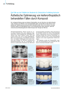 Ästhetische Optimierung von kieferorthopädisch behandelten Fällen