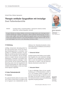 Invisalign Offener Biss