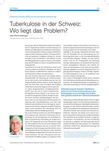 Tuberkulose in der Schweiz: Wo liegt das Problem?
