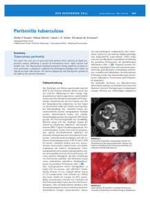 Peritonitis tuberculosa