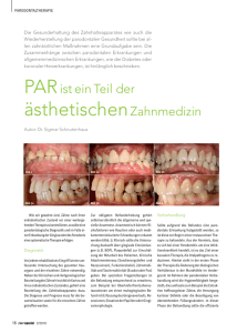 PAR ist ein Teil der ästhetischen Zahnmedizin