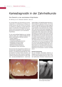 Kariesdiagnostik in der Zahnheilkunde