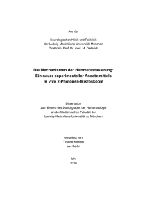 Identifizierung wichtiger Mechanismen der Hirnmetastasierung