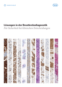 Lösungen in der Brustkrebsdiagnostik