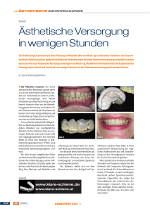 Ästhetische Versorgung in wenigen Stunden