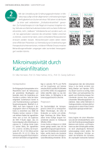 Mikroinvasivität durch Kariesinfiltration