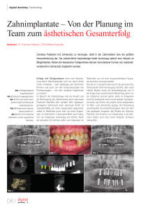 Zahnimplantate – Von der Planung im Team zum ästhetischen