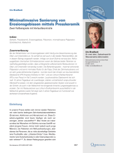 Minimalinvasive Sanierung von Erosionsgebissen mittels