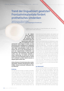 Trend der lingualisiert gesetzten Frontzahnimplantate fordert