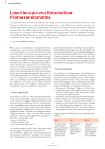 Lasertherapie von fibromatöser Prothesenstomatitis