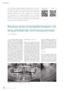 Revision eines Unterkiefermolaren mit lang